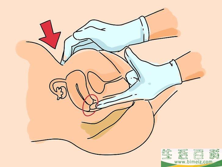 怎么识别子宫颈癌的症状